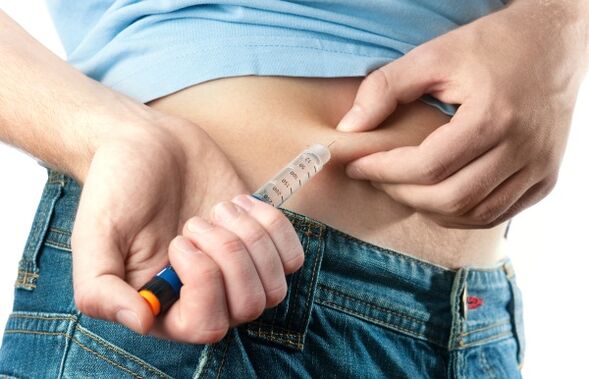 Smagam 2. tipa cukura diabētam nepieciešama insulīna ievadīšana